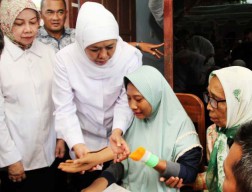 Fitri, Gadis Pemakan Jari asal Kediri Kini Bertangan Palsu