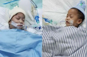 Usai 9 Jam Operasi Pemisahan, Aqila-Azila Sudah Senyum