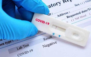 Rapid Test 11.067 Warga Jatim: 266 Positif Terjangkit Corona